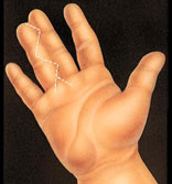 Hand Surgery | Hand Injuries | NJ