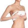 Breast Augmentation