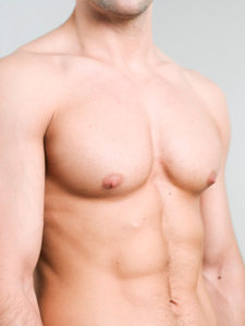 man boobs gynecomastia