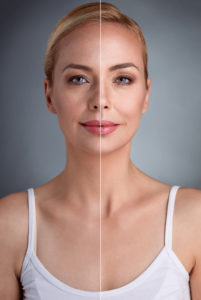 Laser Skin Resurfacing Little Silver, NJ